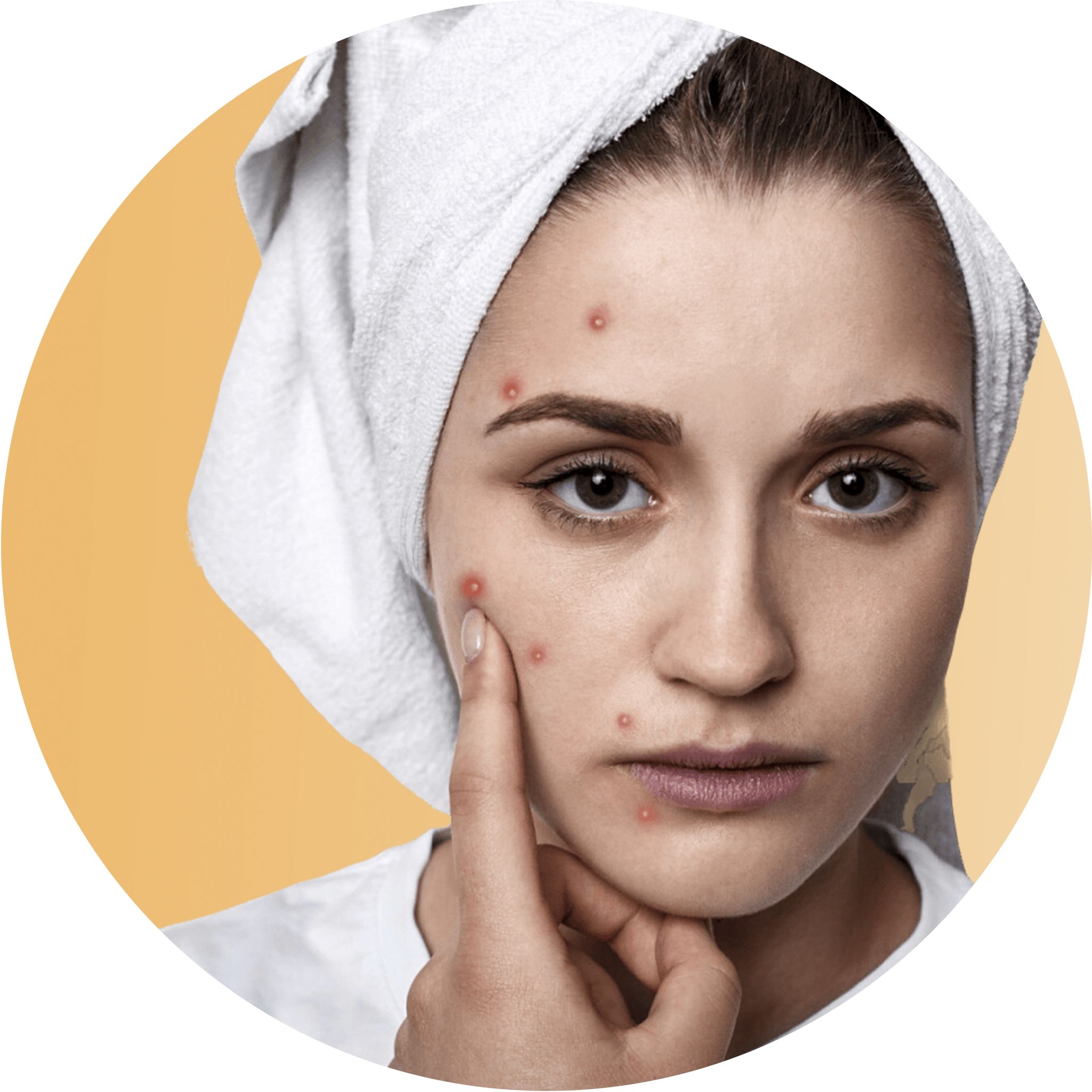 Scar Removal Treatment In Hyderabad Scar Removal Treatment In Hyderabad